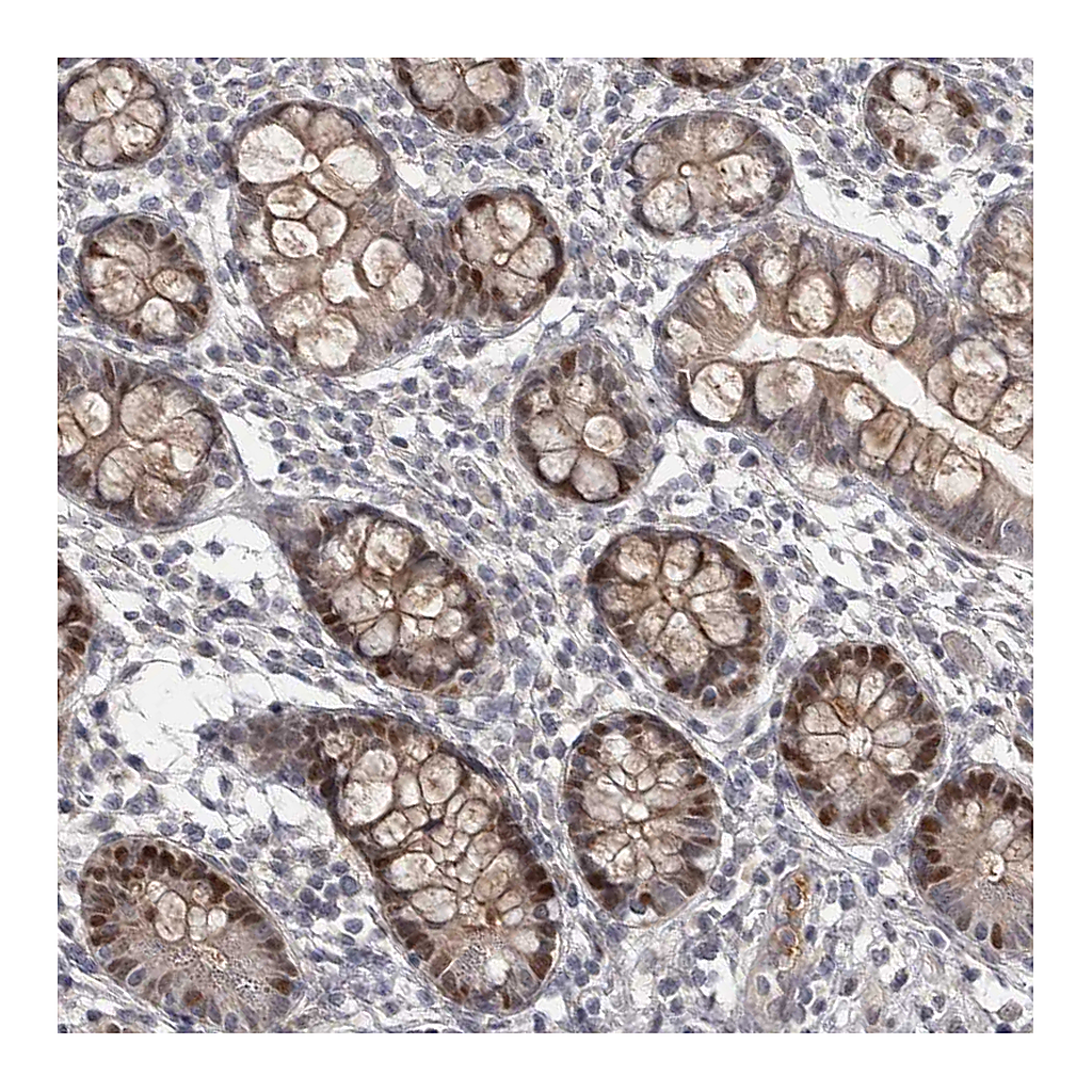 Atlas Antibodies Anti-ZNF277 Antibody