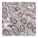 Atlas Antibodies Anti-ZNF277 Antibody