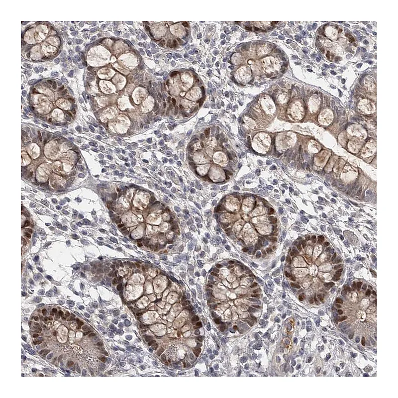 Atlas Antibodies Anti-ZNF277 Antibody