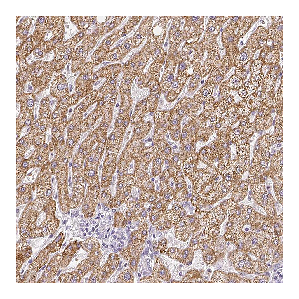 Atlas Antibodies Anti-ZNF280B Antibody