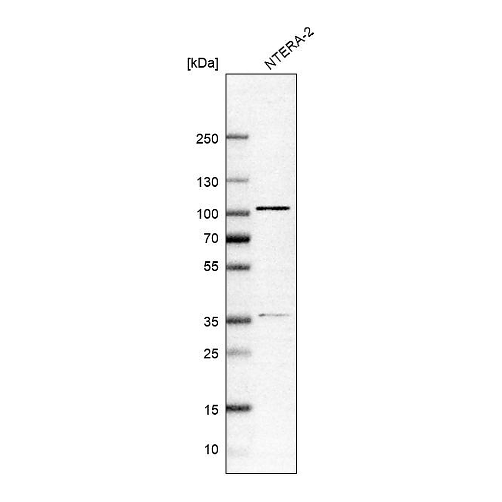 Atlas Antibodies Anti-ZNF281 Antibody