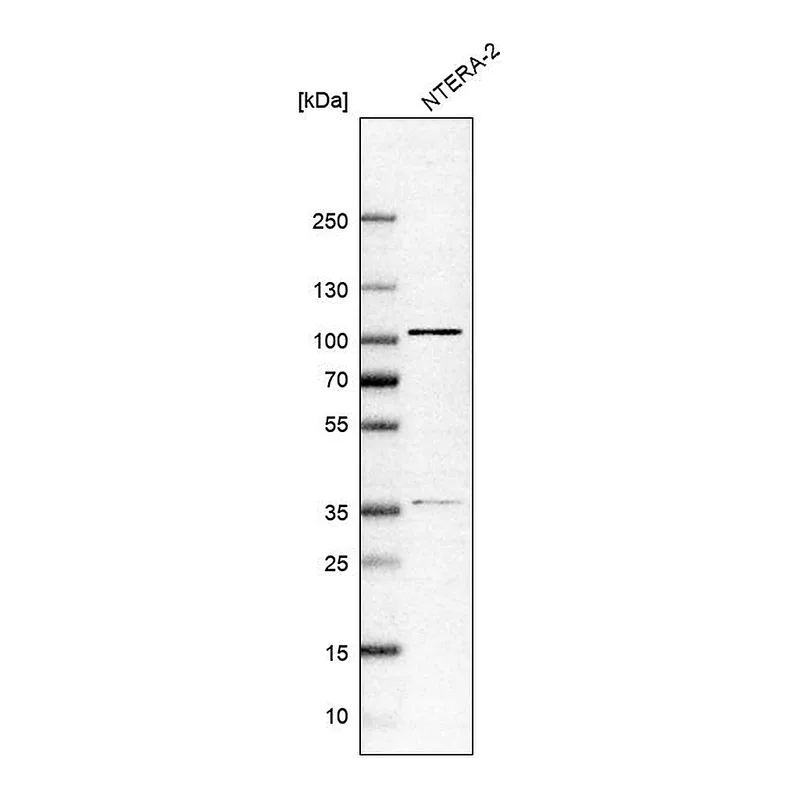 Atlas Antibodies Anti-ZNF281 Antibody