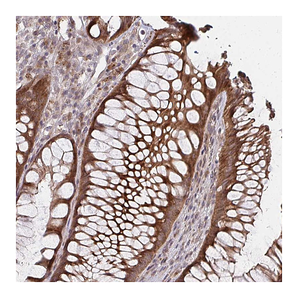 Atlas Antibodies Anti-ZNF285 Antibody