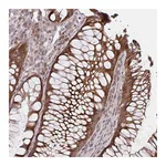 Atlas Antibodies Anti-ZNF285 Antibody