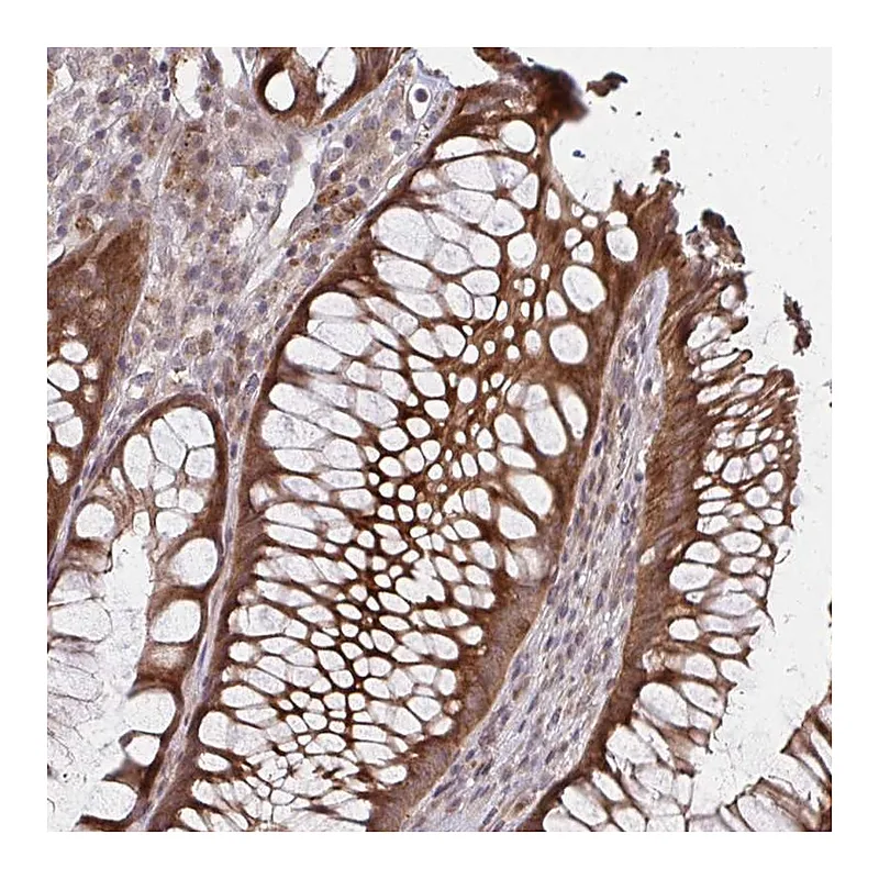 Atlas Antibodies Anti-ZNF285 Antibody