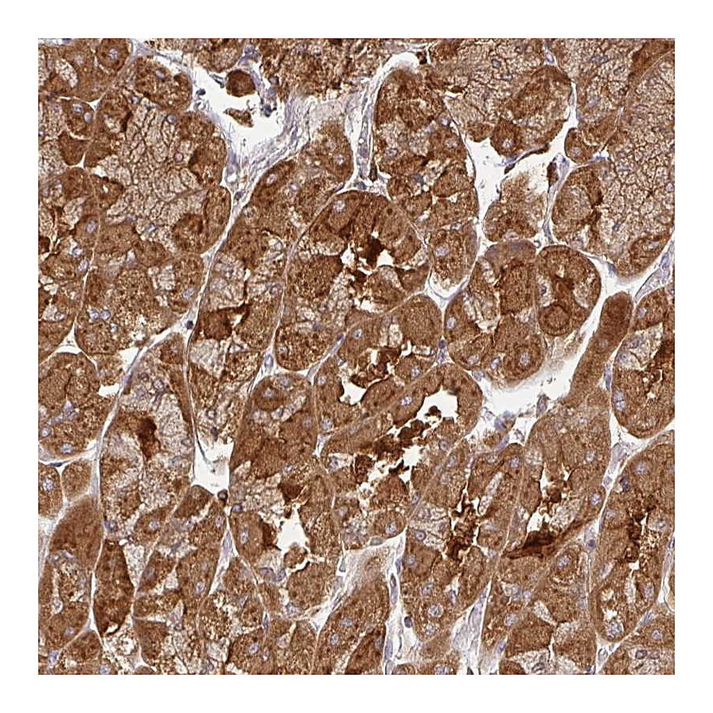Atlas Antibodies Anti-ZNF285 Antibody
