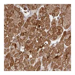 Atlas Antibodies Anti-ZNF285 Antibody