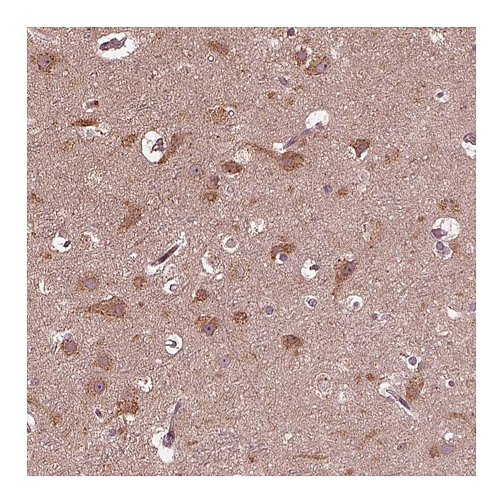 Atlas Antibodies Anti-ZNF292 Antibody