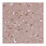 Atlas Antibodies Anti-ZNF292 Antibody