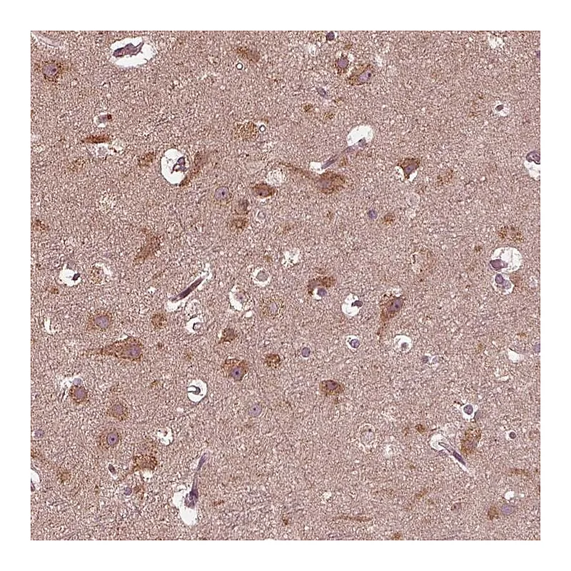Atlas Antibodies Anti-ZNF292 Antibody