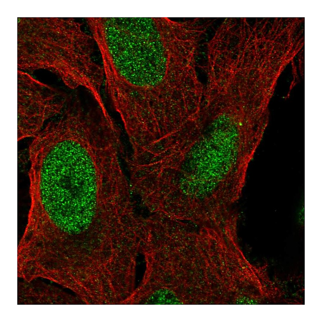 Atlas Antibodies Anti-ZNF296 Antibody