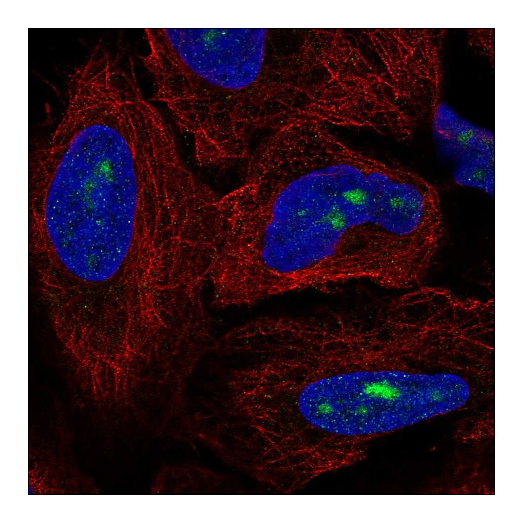 Atlas Antibodies Anti-ZNF286A Antibody