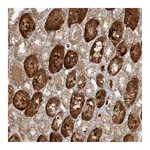 Atlas Antibodies Anti-ZNF287 Antibody