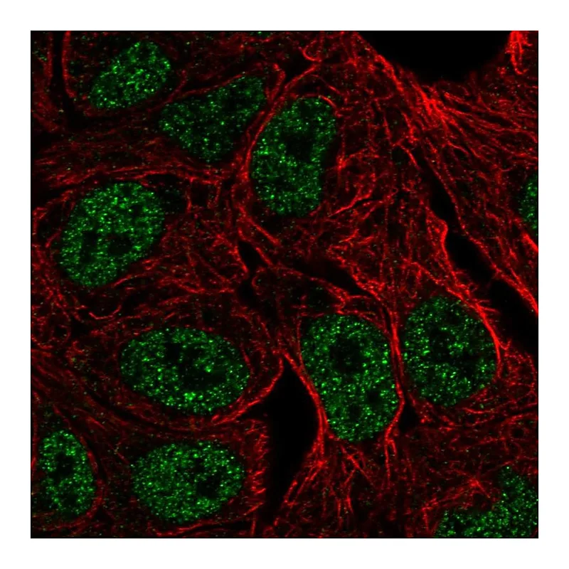 Atlas Antibodies Anti-ZNF283 Antibody