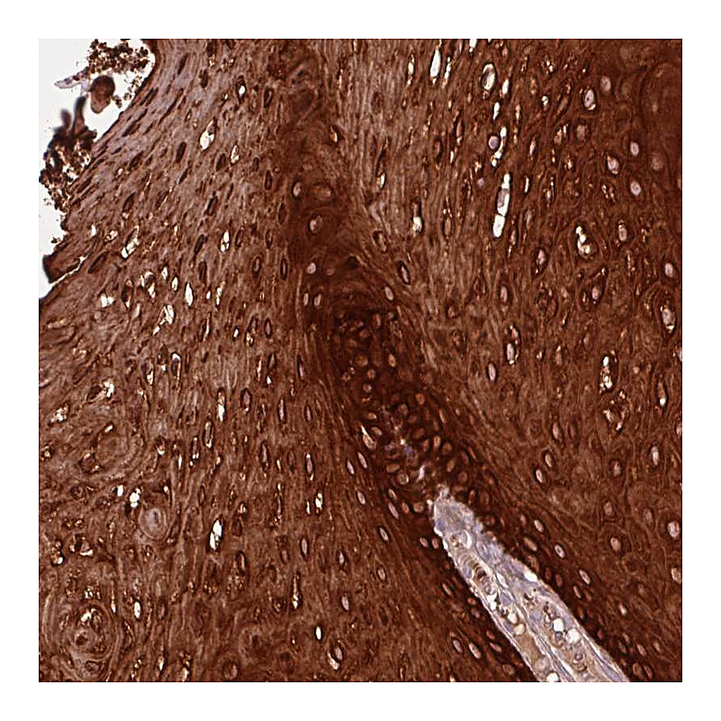 Atlas Antibodies Anti-ZNF286B Antibody
