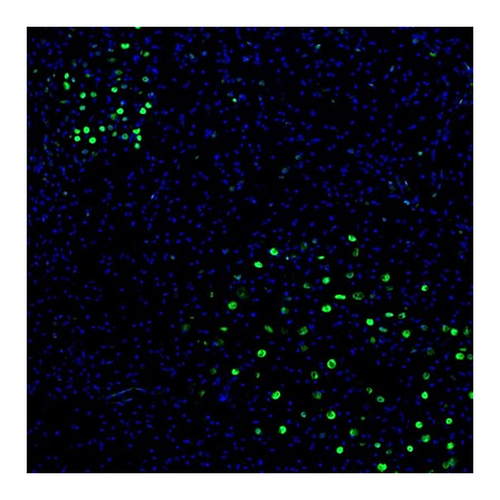 Atlas Antibodies Anti-ZNF3 Antibody