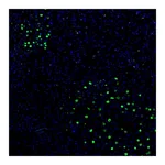 Atlas Antibodies Anti-ZNF3 Antibody