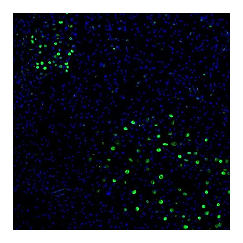 Atlas Antibodies Anti-ZNF3 Antibody