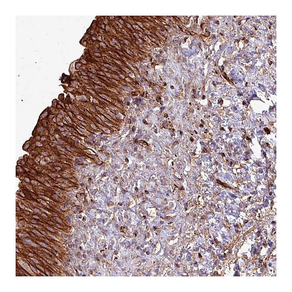 Atlas Antibodies Anti-ZNF300 Antibody