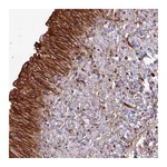 Atlas Antibodies Anti-ZNF300 Antibody