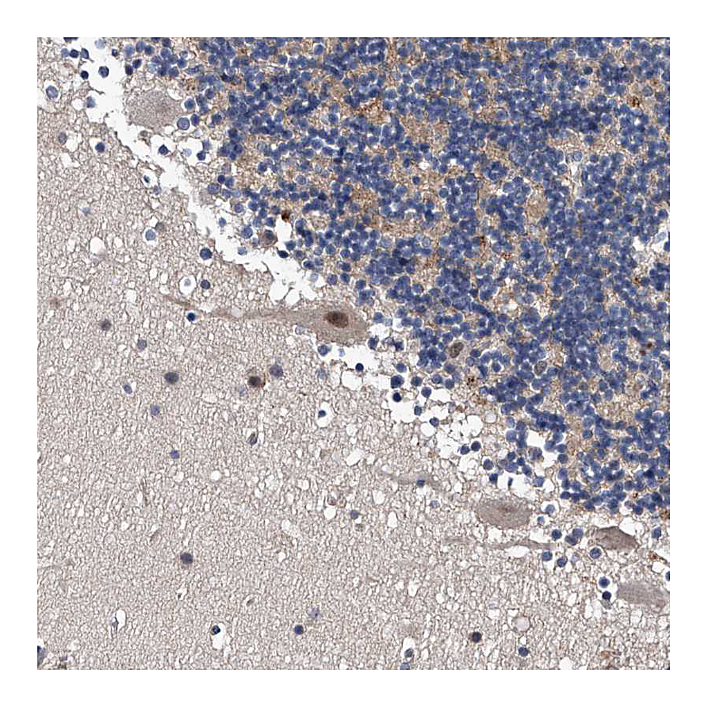 Atlas Antibodies Anti-ZNF30 Antibody