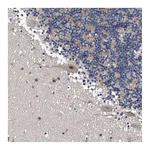 Atlas Antibodies Anti-ZNF30 Antibody