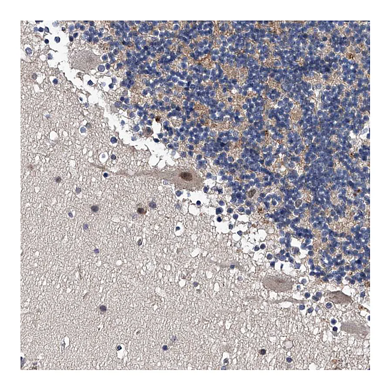Atlas Antibodies Anti-ZNF30 Antibody