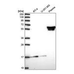 Atlas Antibodies Anti-ZNF317 Antibody