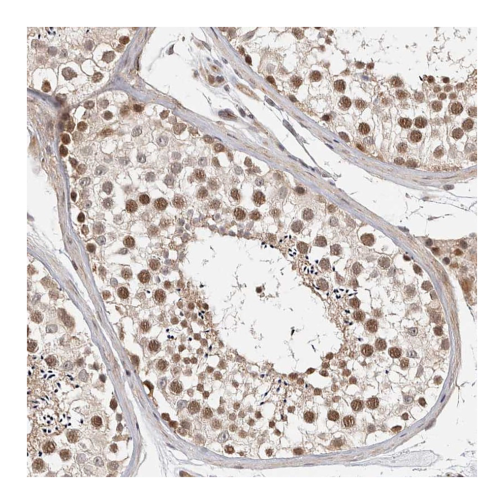 Atlas Antibodies Anti-ZNF318 Antibody