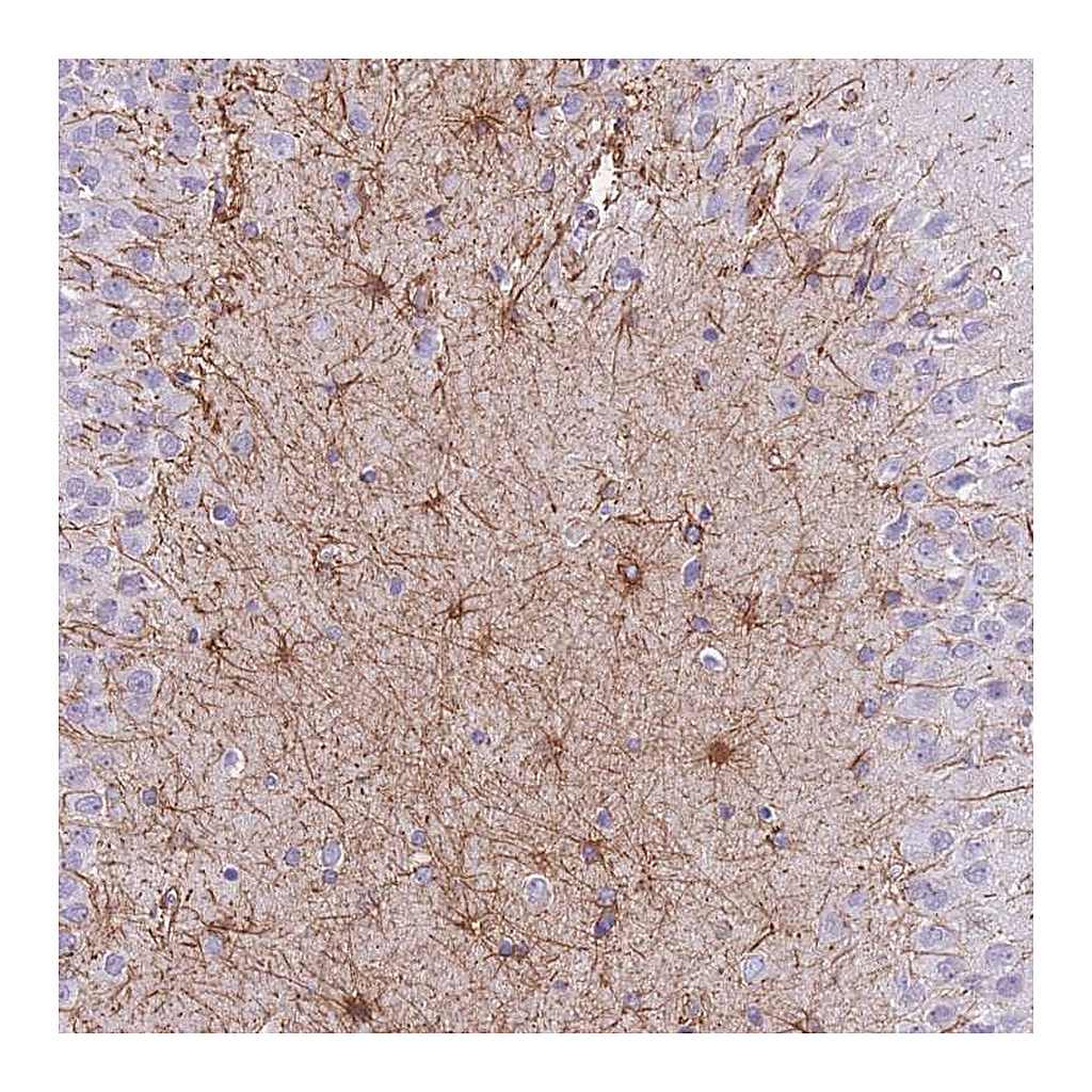 Atlas Antibodies Anti-ZNF311 Antibody
