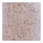 Atlas Antibodies Anti-ZNF311 Antibody