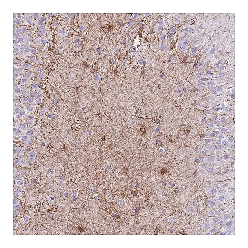 Atlas Antibodies Anti-ZNF311 Antibody