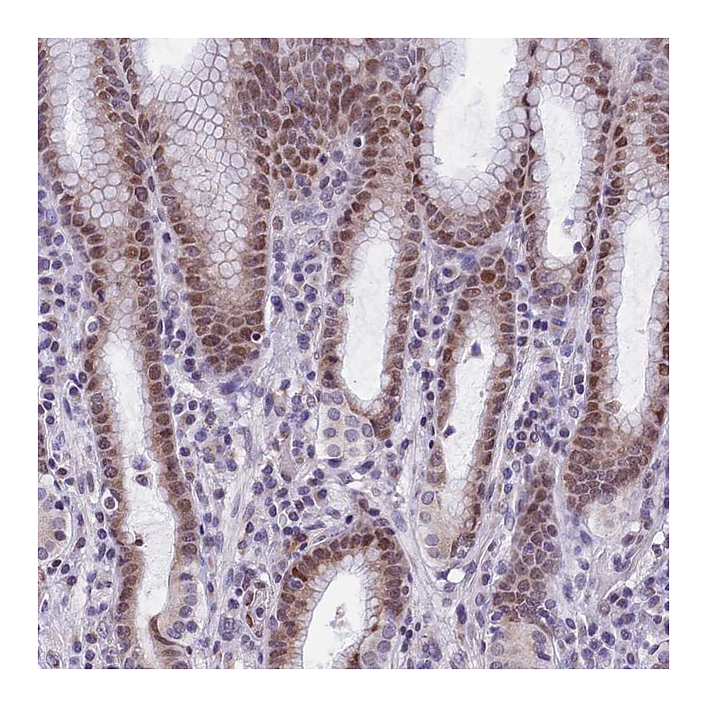 Atlas Antibodies Anti-ZNF317 Antibody