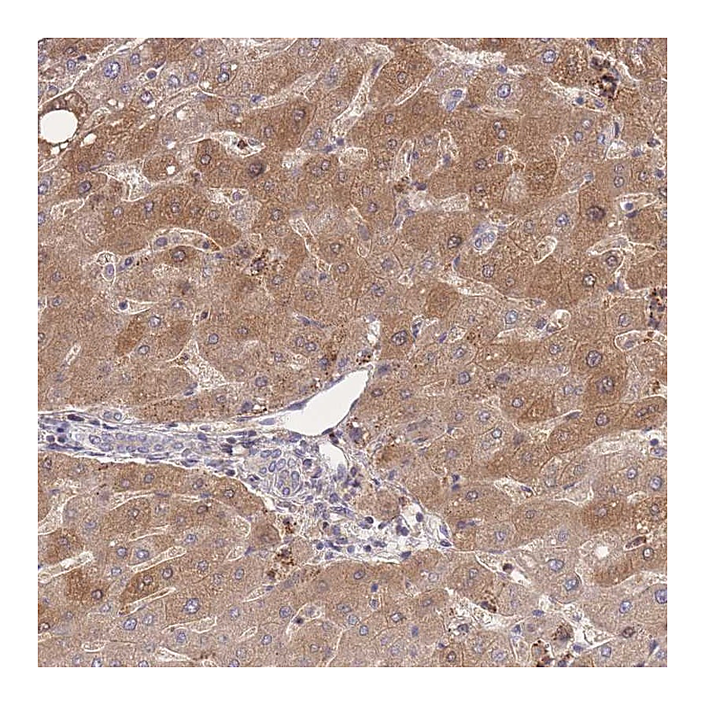 Atlas Antibodies Anti-ZNF304 Antibody