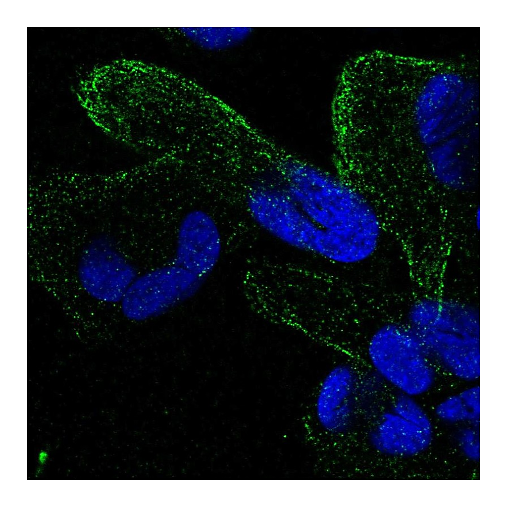 Atlas Antibodies Anti-ZNF302 Antibody