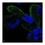 Atlas Antibodies Anti-ZNF302 Antibody