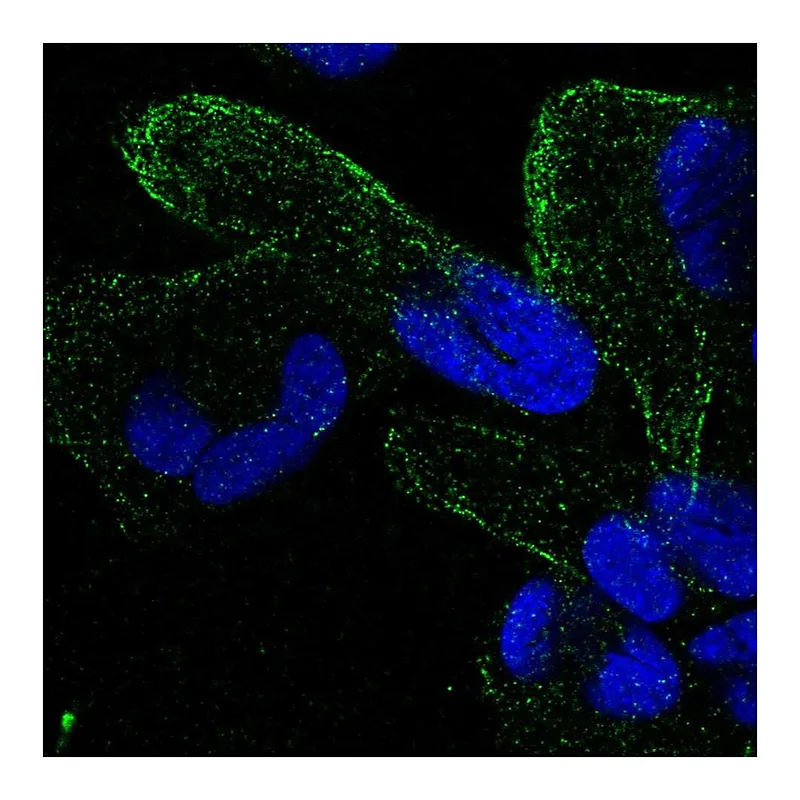 Atlas Antibodies Anti-ZNF302 Antibody
