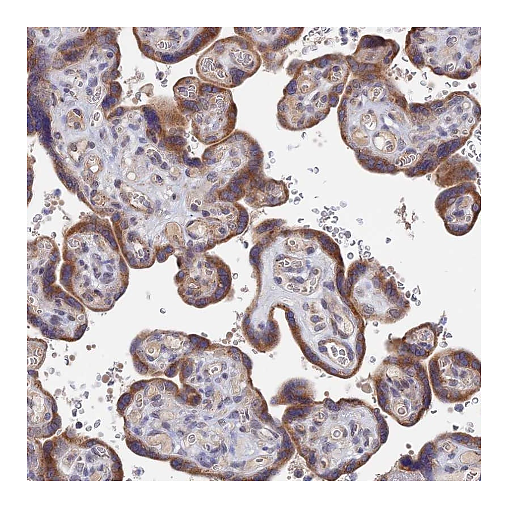 Atlas Antibodies Anti-ZNF320 Antibody