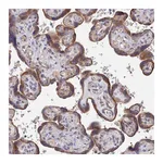 Atlas Antibodies Anti-ZNF320 Antibody