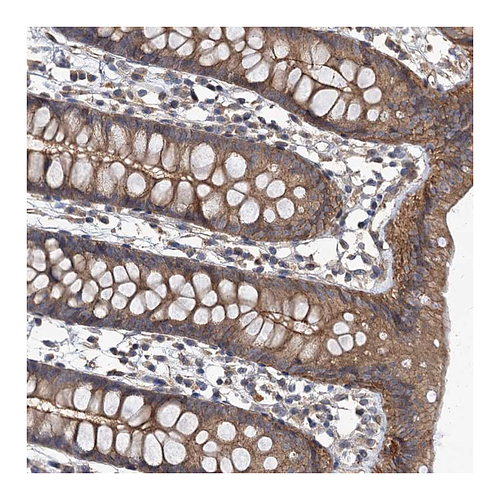 Atlas Antibodies Anti-ZNF324 Antibody