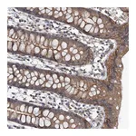 Atlas Antibodies Anti-ZNF324 Antibody