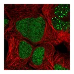 Atlas Antibodies Anti-ZNF32 Antibody
