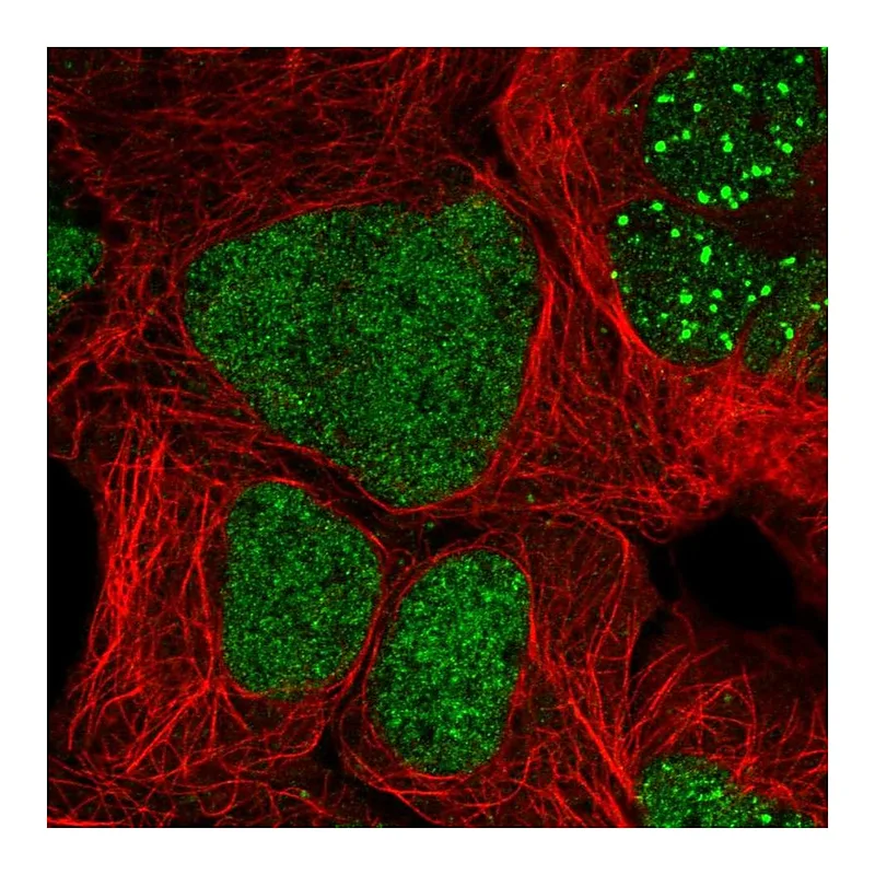Atlas Antibodies Anti-ZNF32 Antibody