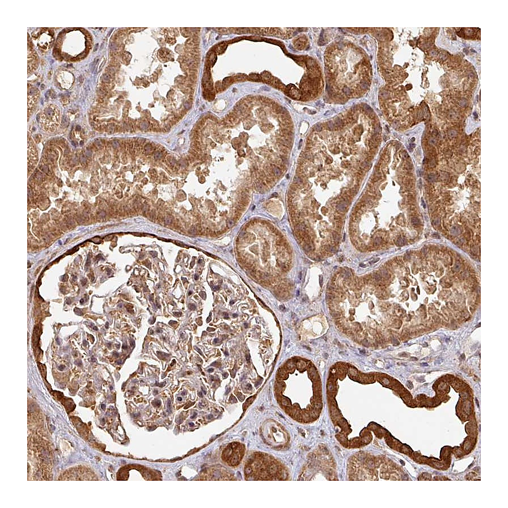 Atlas Antibodies Anti-ZNF322 Antibody