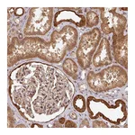 Atlas Antibodies Anti-ZNF322 Antibody