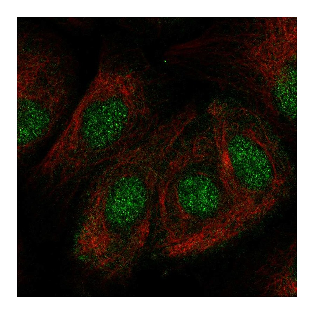 Atlas Antibodies Anti-ZNF319 Antibody