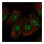 Atlas Antibodies Anti-ZNF319 Antibody