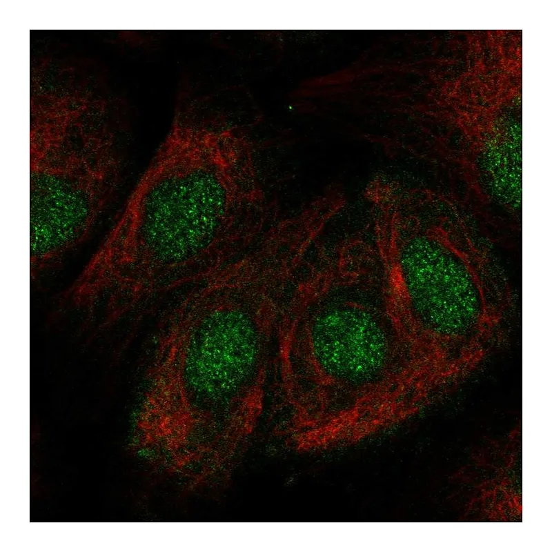 Atlas Antibodies Anti-ZNF319 Antibody