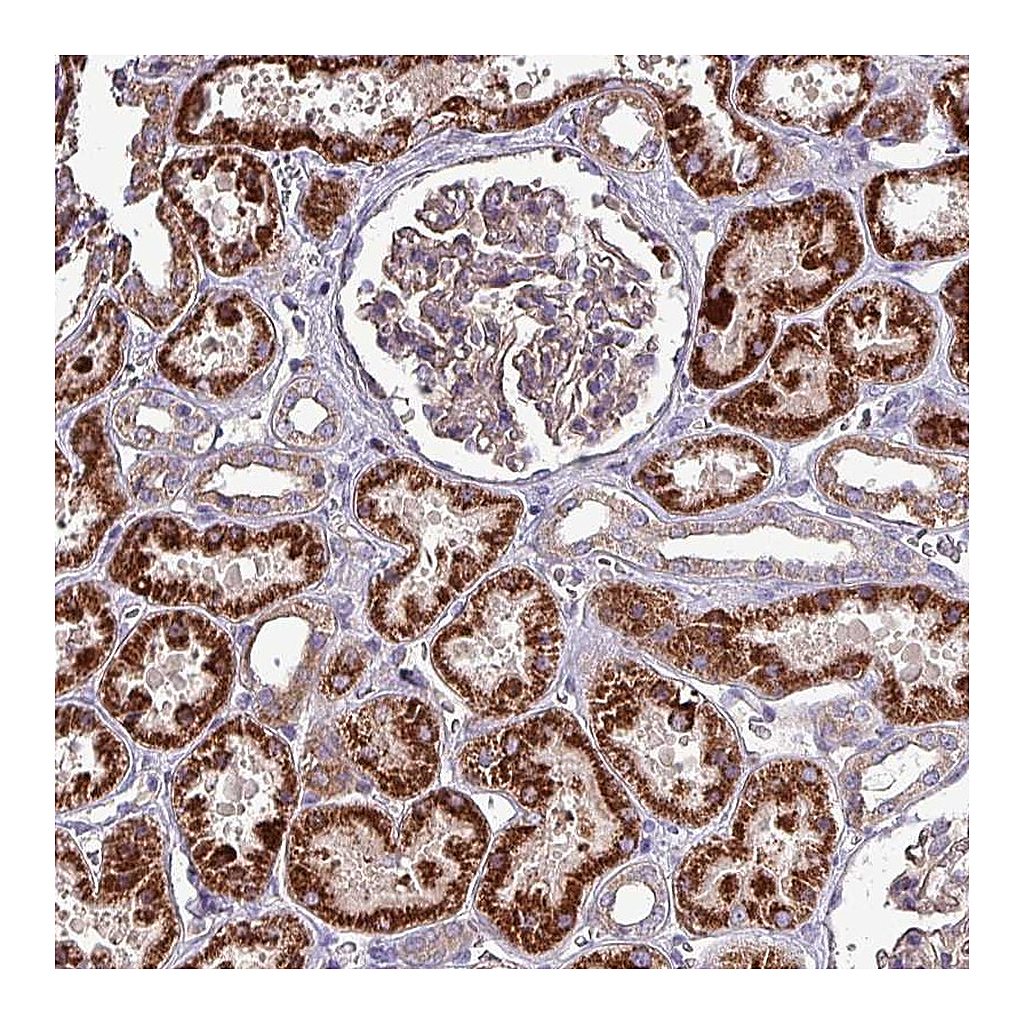 Atlas Antibodies Anti-ZNF322 Antibody