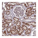 Atlas Antibodies Anti-ZNF322 Antibody